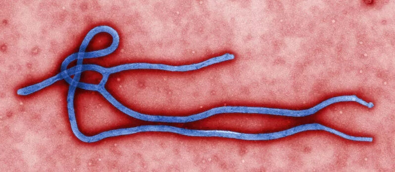 Ebola Virus under microscope