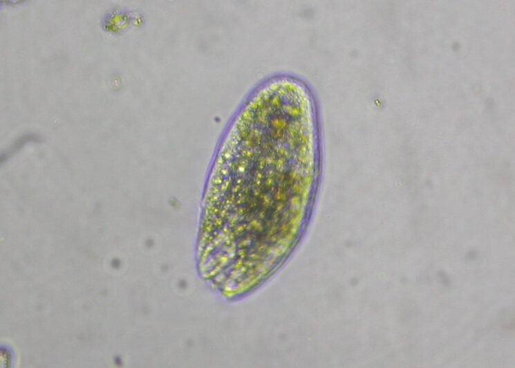 Protozoa under microscope