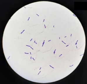 Bacilli bacteria under microscope
