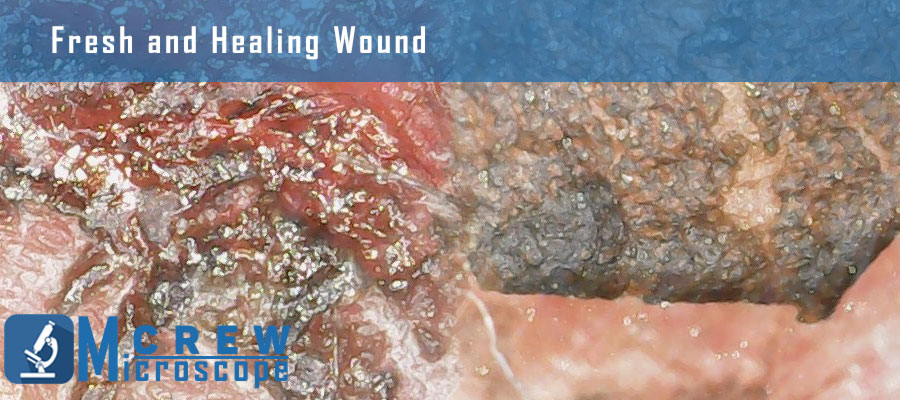 fresh-and-healing-wound